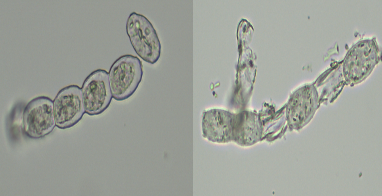 白粉病菌丝体光学显微镜镜检数据
